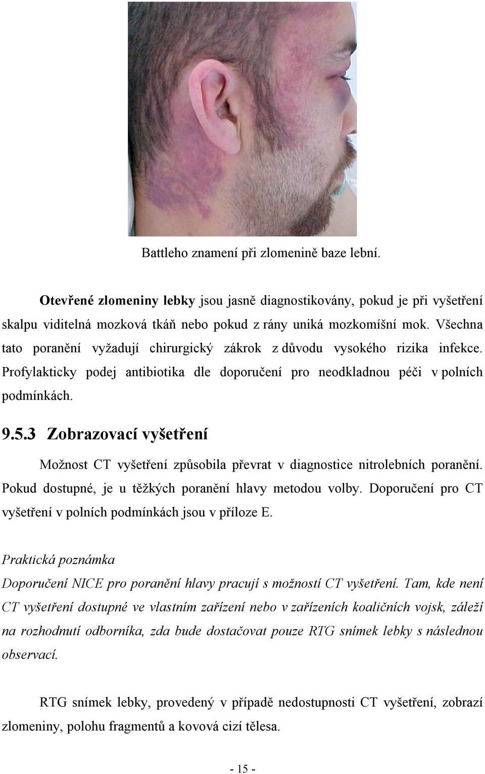 3 Zobrazovací vyšetření Možnost CT vyšetření způsobila převrat v diagnostice nitrolebních poranění. Pokud dostupné, je u těžkých poranění hlavy metodou volby.