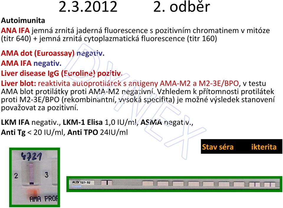 160) AMA dot (Euroassay) negativ. AMA IFA negativ. Liver disease IgG (Euroline) pozitiv.