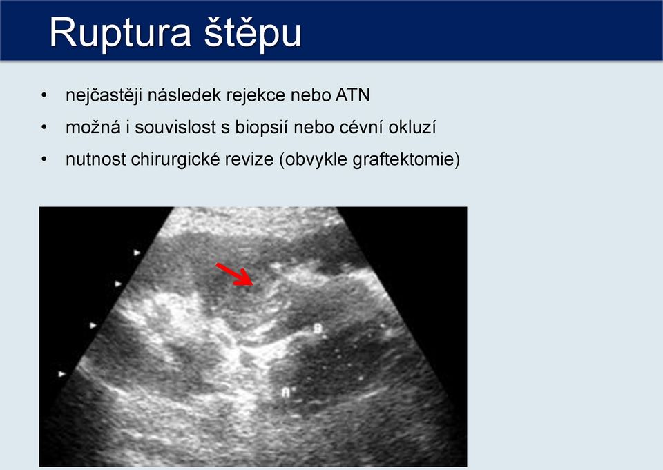 s biopsií nebo cévní okluzí nutnost