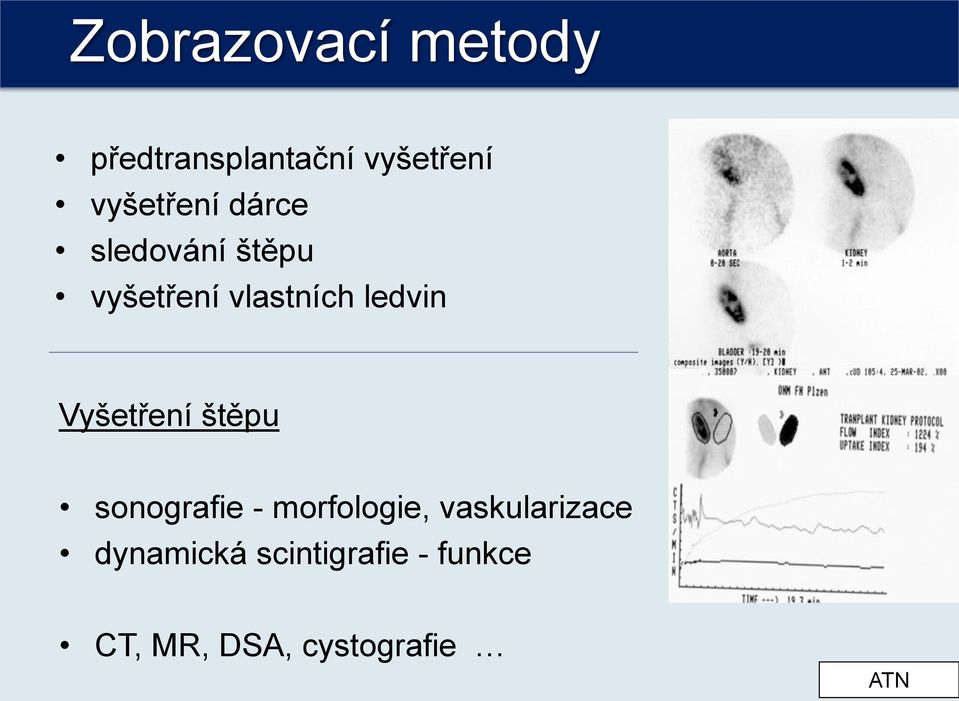 ledvin Vyšetření štěpu sonografie - morfologie,