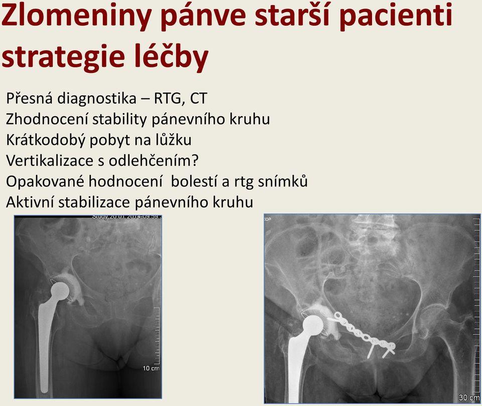 pobyt na lůžku Vertikalizace s odlehčením?