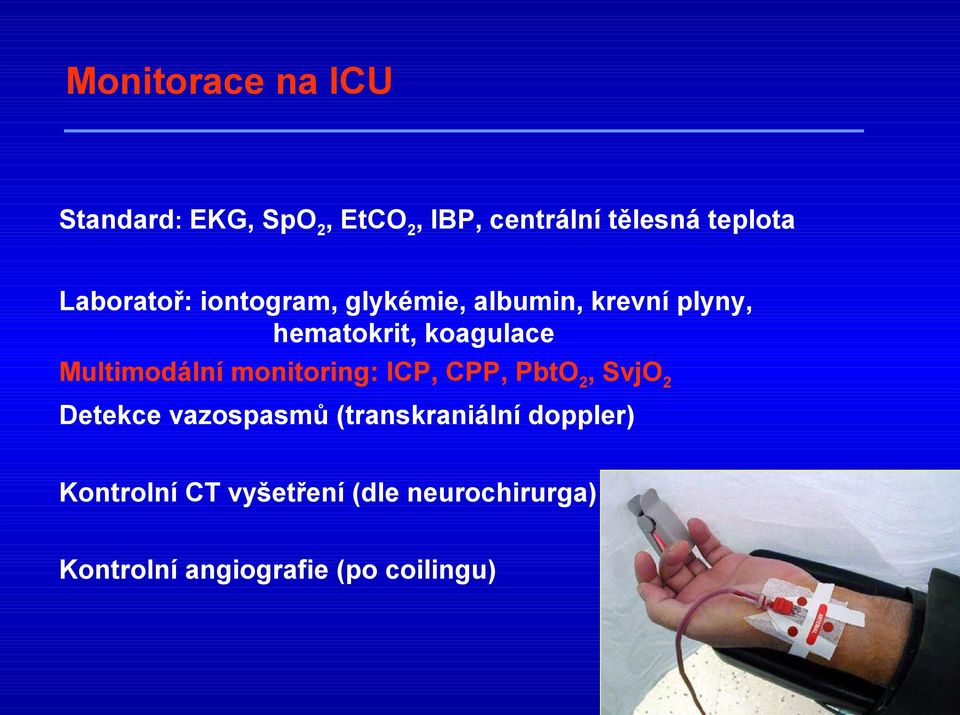 Multimodální monitoring: ICP, CPP, PbtO2, SvjO2 Detekce vazospasmů