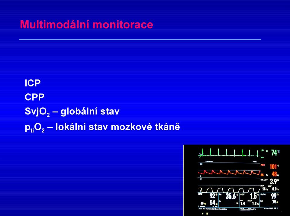 SvjO2 globální stav