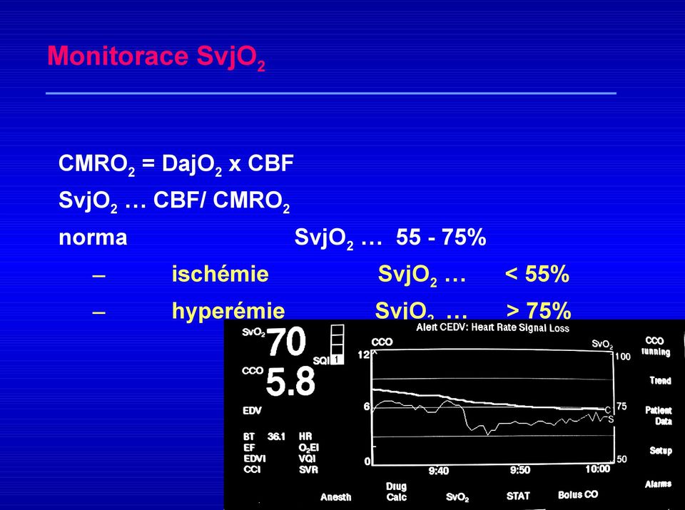 norma SvjO2 55-75% ischémie