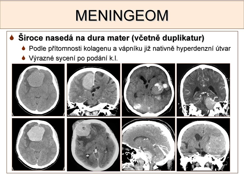 kolagenu a vápníku již nativně