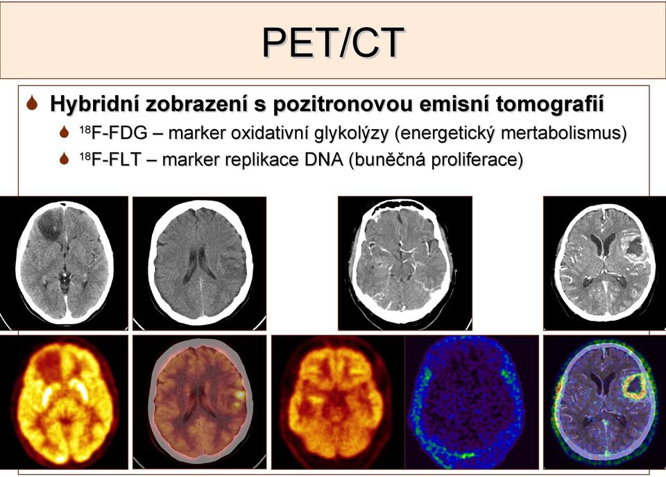 glykolýzy (energetický mertabolismus) 18