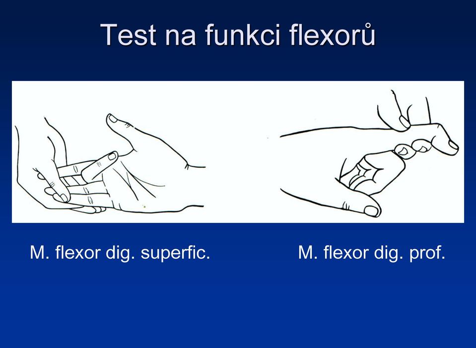 flexor dig.