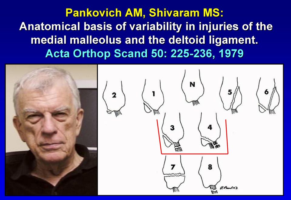 the medial malleolus and the deltoid