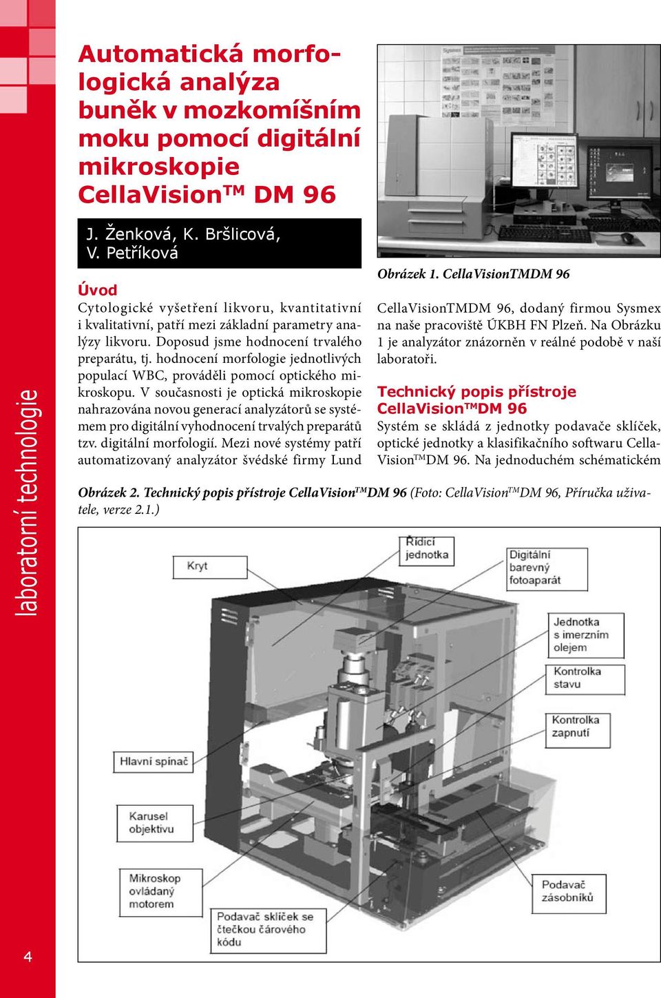 hodnocení morfologie jednotlivých populací WBC, prováděli pomocí optického mikroskopu.