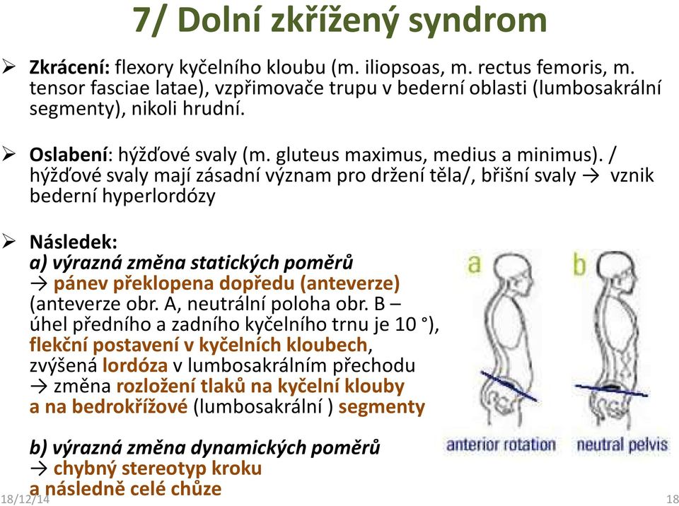 / hýžďové svaly mají zásadní význam pro držení těla/, břišní svaly vznik bederní hyperlordózy Následek: a) výrazná změna statických poměrů pánev překlopena dopředu (anteverze) (anteverze obr.