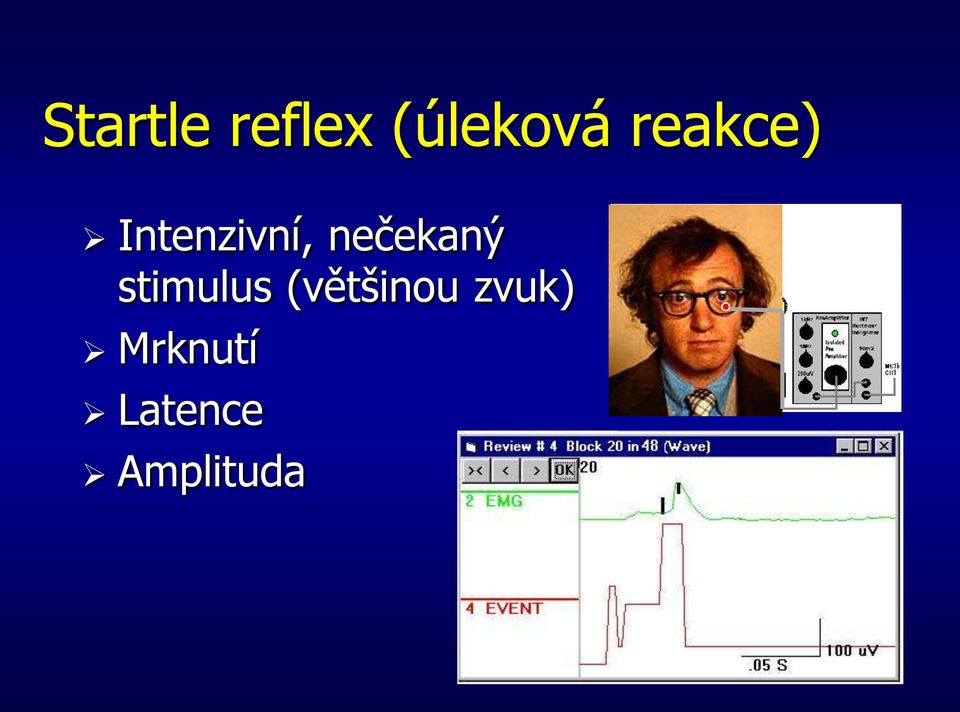 nečekaný stimulus