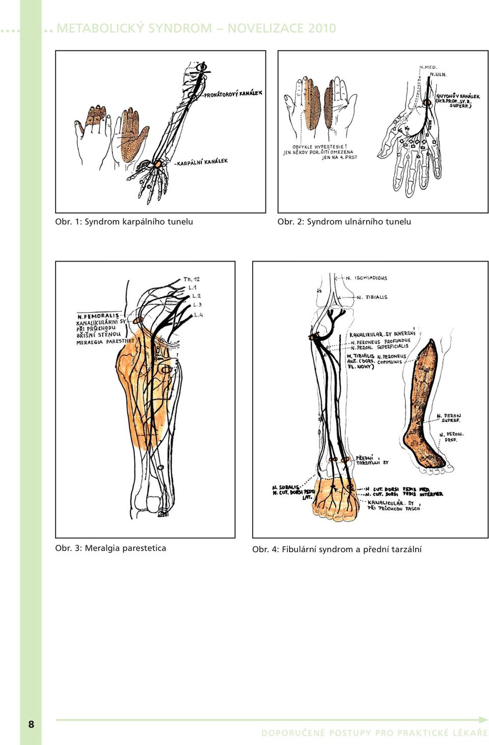 Obr. 3: Meralgia parestetica Obr.