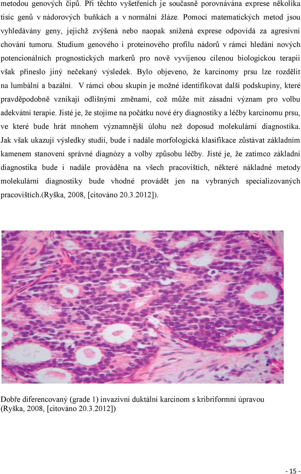 Studium genového i proteinového profilu nádorů v rámci hledání nových potencionálních prognostických markerů pro nově vyvíjenou cílenou biologickou terapii však přineslo jiný nečekaný výsledek.