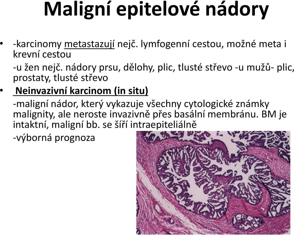 nádory prsu, dělohy, plic, tlusté střevo -u mužů- plic, prostaty, tlusté střevo Neinvazivní karcinom