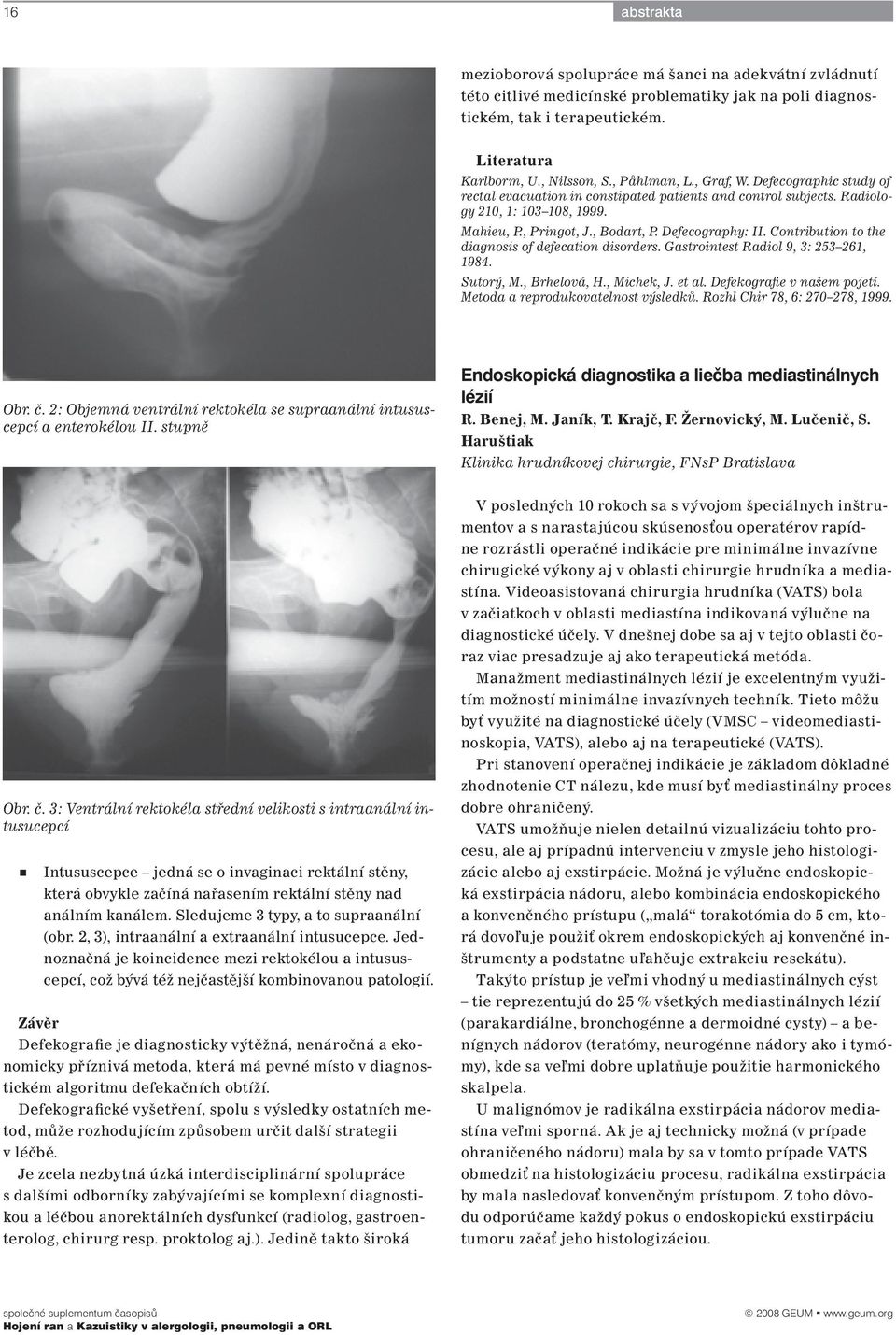 Contribution to the diagnosis of defecation disorders. Gastrointest Radiol 9, 3: 253 261, 1984. Sutorý, M., Brhelová, H., Michek, J. et al. Defekografie v našem pojetí.