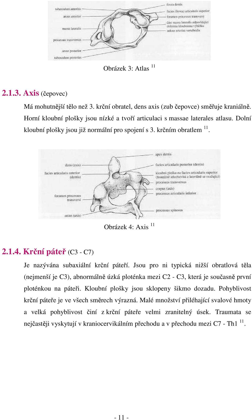 ..Je nazývána subaxiální krční páteří. Jsou pro ni typická nižší obratlová těla...(nejmenší je C3), abnormálně úzká ploténka mezi C2 - C3, která je současně první...ploténkou na páteři.