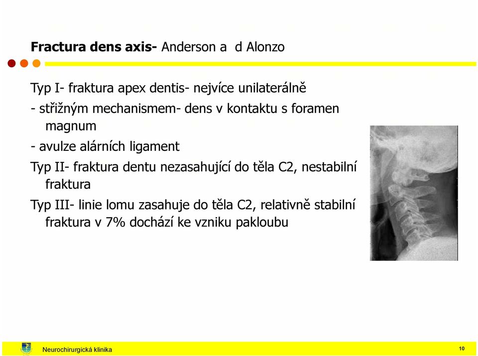 fraktura dentu nezasahující do těla C2, nestabilní fraktura Typ III- linie lomu zasahuje do