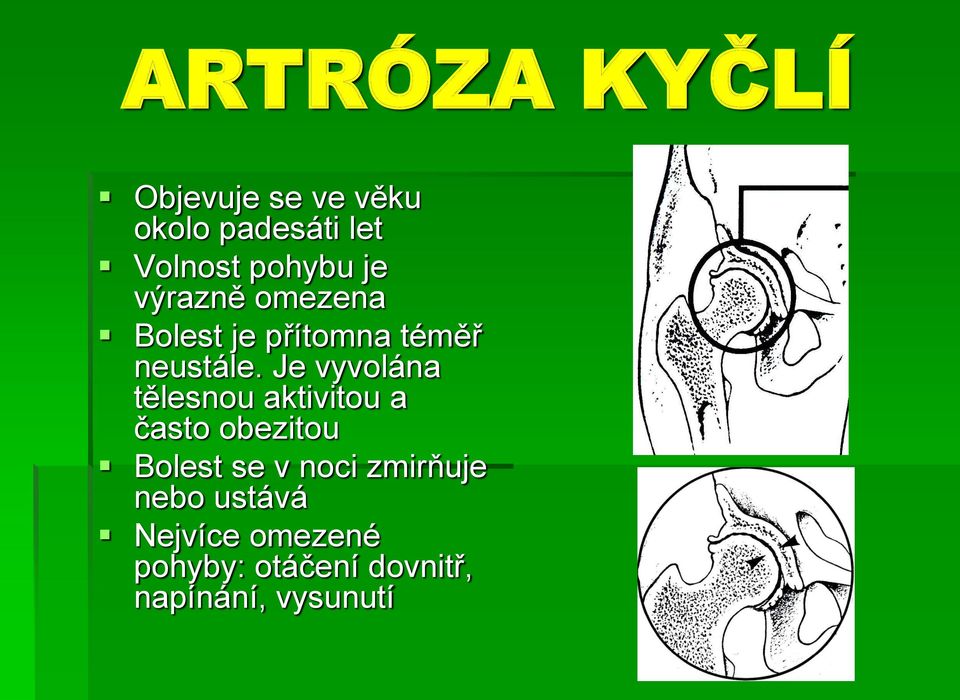 Je vyvolána tělesnou aktivitou a často obezitou Bolest se v noci