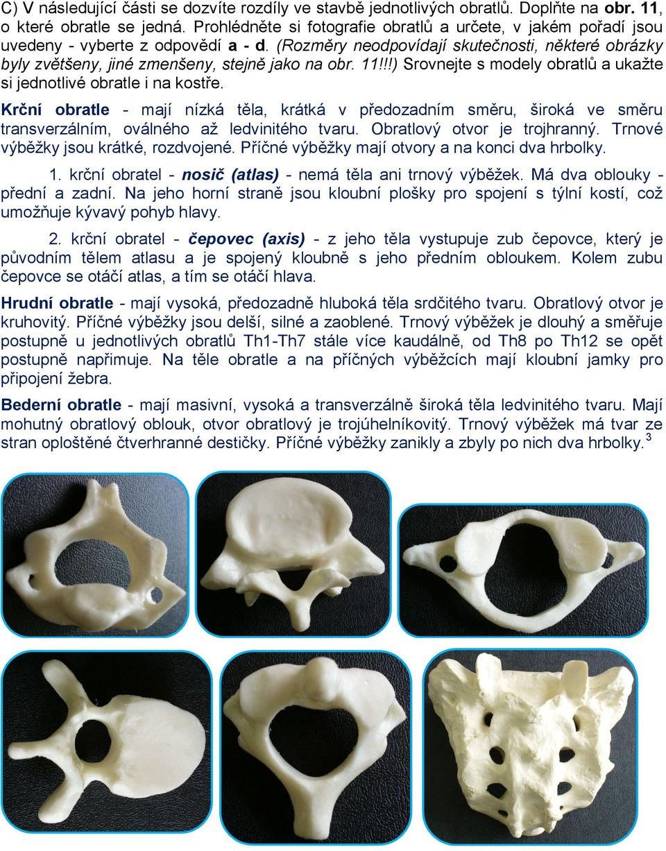 11!!!) Srovnejte s modely obratlů a ukažte si jednotlivé obratle i na kostře.