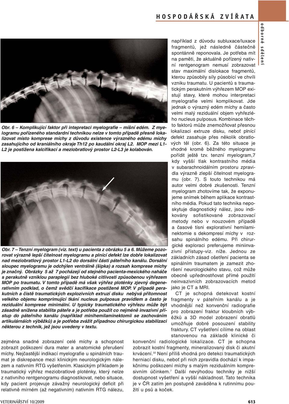 okraj L2. MOP mezi L1- L2 je postižena kalcifikací a meziobratlový prostor L2-L3 je kolabován. Obr. 7 Tenzní myelogram (viz. text) u pacienta z obrázku 5 a 6.