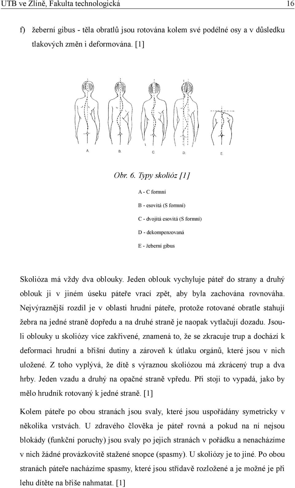 Jeden oblouk vychyluje páteř do strany a druhý oblouk ji v jiném úseku páteře vrací zpět, aby byla zachována rovnováha.