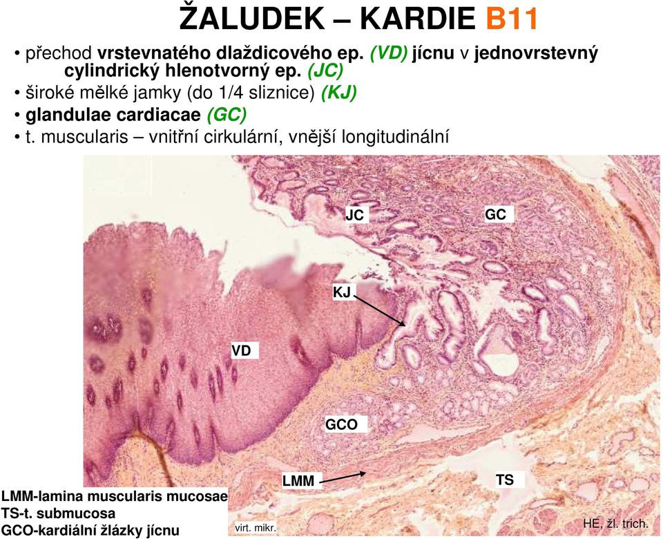 (JC) široké mělké jamky (do 1/4 sliznice) (KJ) glandulae cardiacae (GC) t.