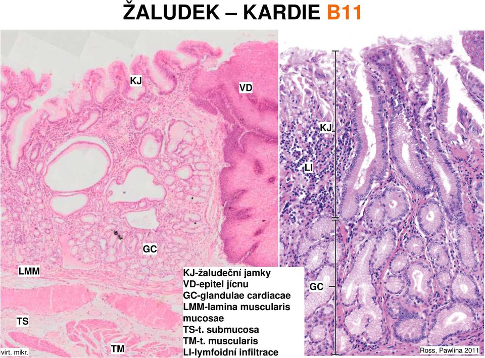 muscularis mucosae TS-t. submucosa TM-t.