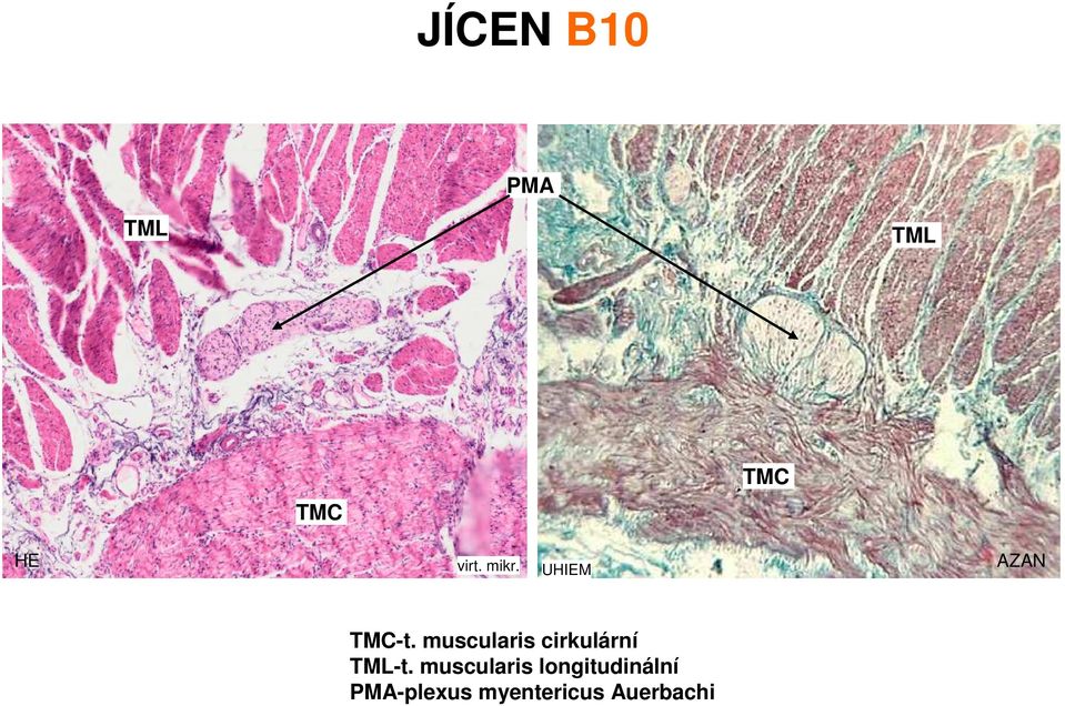 muscularis cirkulární TML-t.