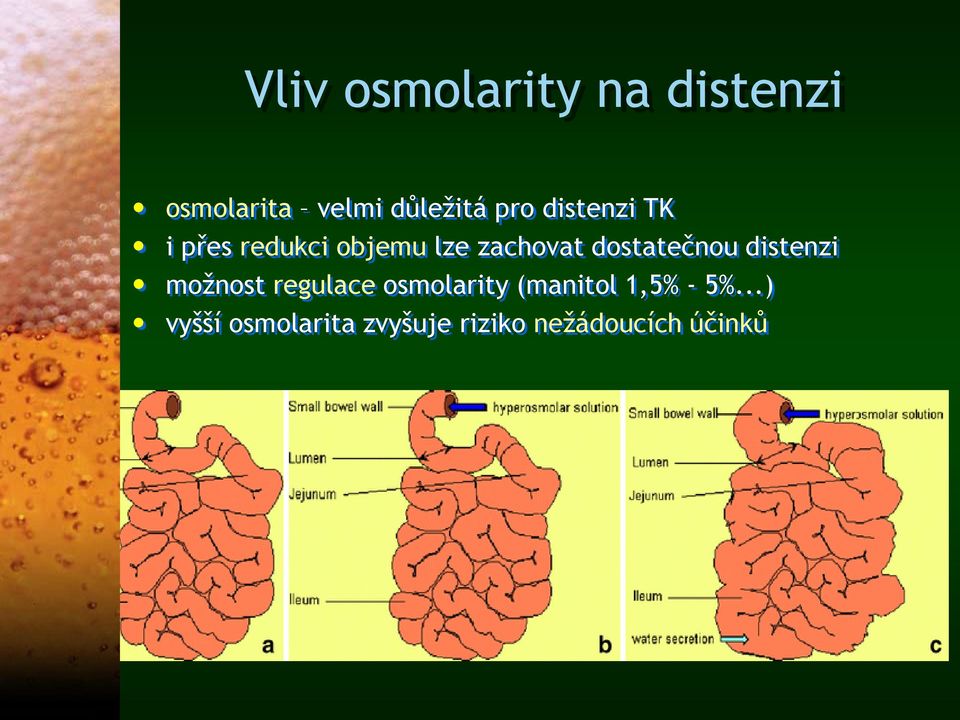 5%...) vyšší osmolarita zvyšuje riziko nežádoucích účinků Waleed A. et al.