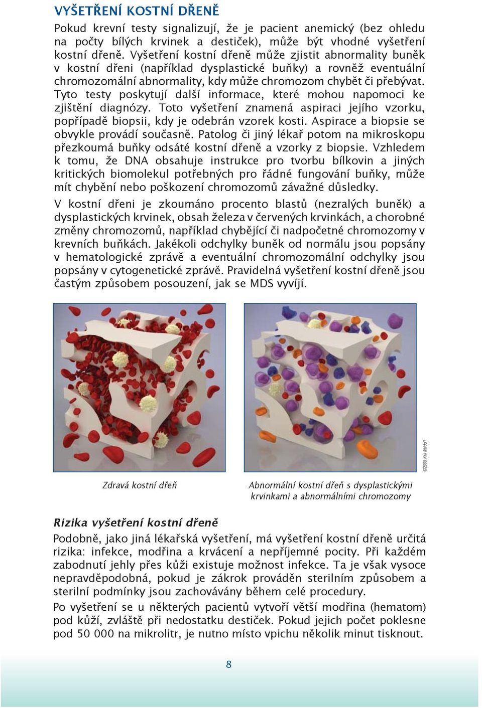 Tyto testy poskytují další informace, které mohou napomoci ke zjištění diagnózy. Toto vyšetření znamená aspiraci jejího vzorku, popřípadě biopsii, kdy je odebrán vzorek kosti.