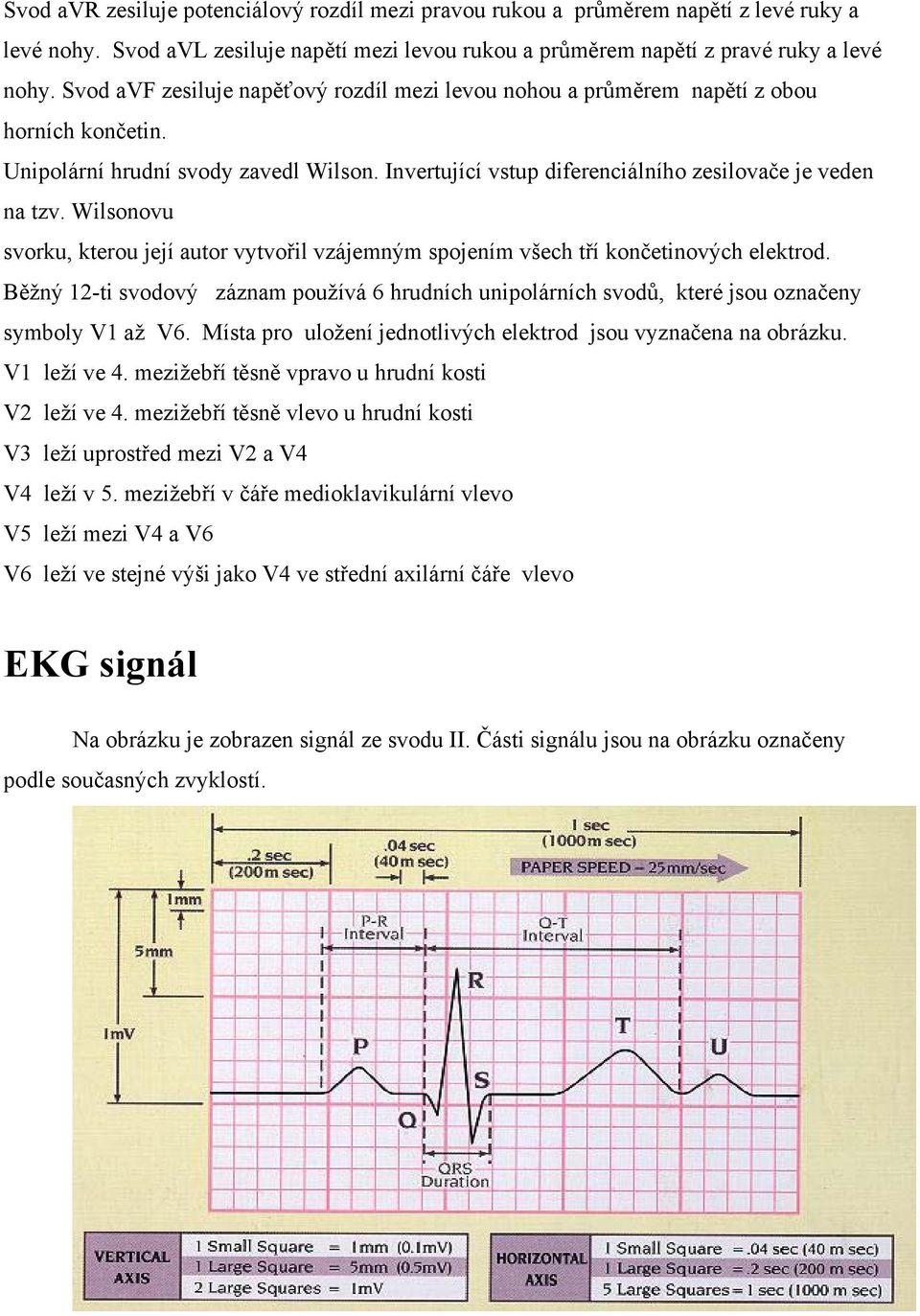 Wilsonovu svorku, kterou její autor vytvořil vzájemným spojením všech tří končetinových elektrod.