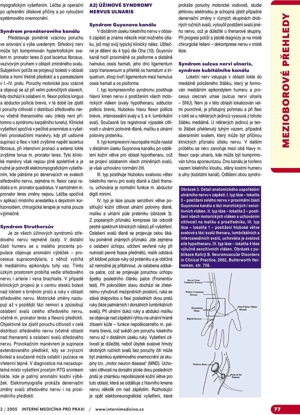 pronator teres či pod lacertus fibrosus, vazivovým pruhem v oblasti zmíněného svalu. Subjektivní potíže se projevují bolestí v oblasti lokte a horní třetině předloktí a s paresteziemi v I. IV. prstu.