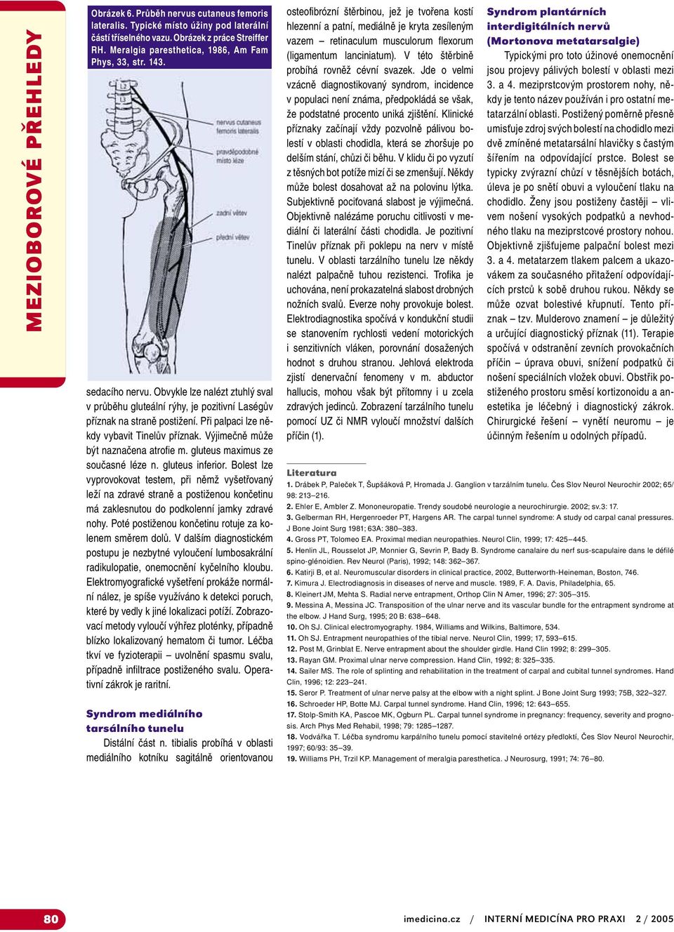 Výjimečně může být naznačena atrofie m. gluteus maximus ze současné léze n. gluteus inferior.