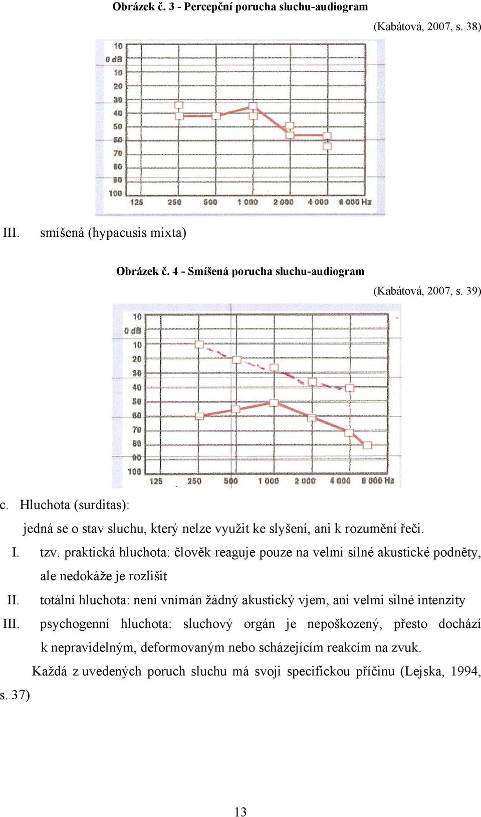 praktická hluchota: člověk reaguje pouze na velmi silné akustické podněty, ale nedokáže je rozlišit II.