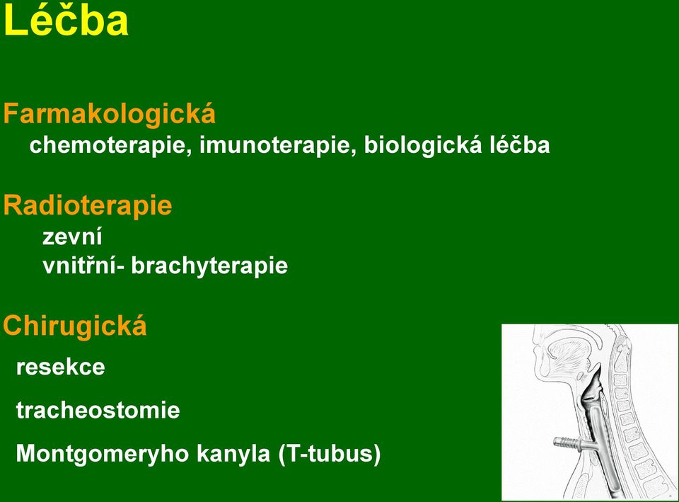 Radioterapie zevní vnitřní- brachyterapie