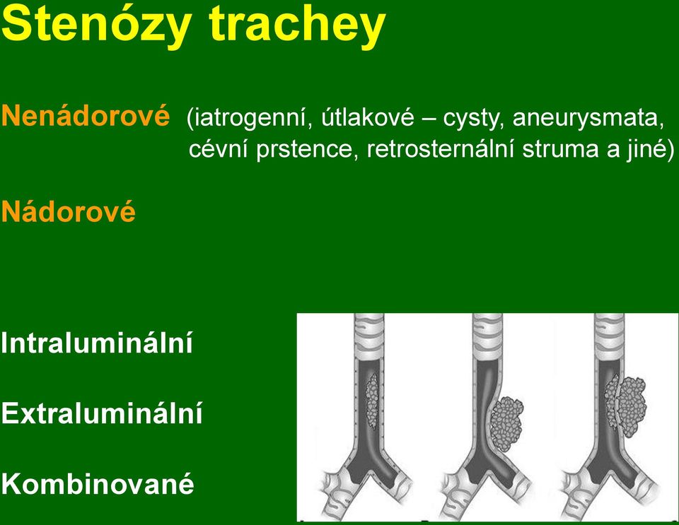 prstence, retrosternální struma a jiné)