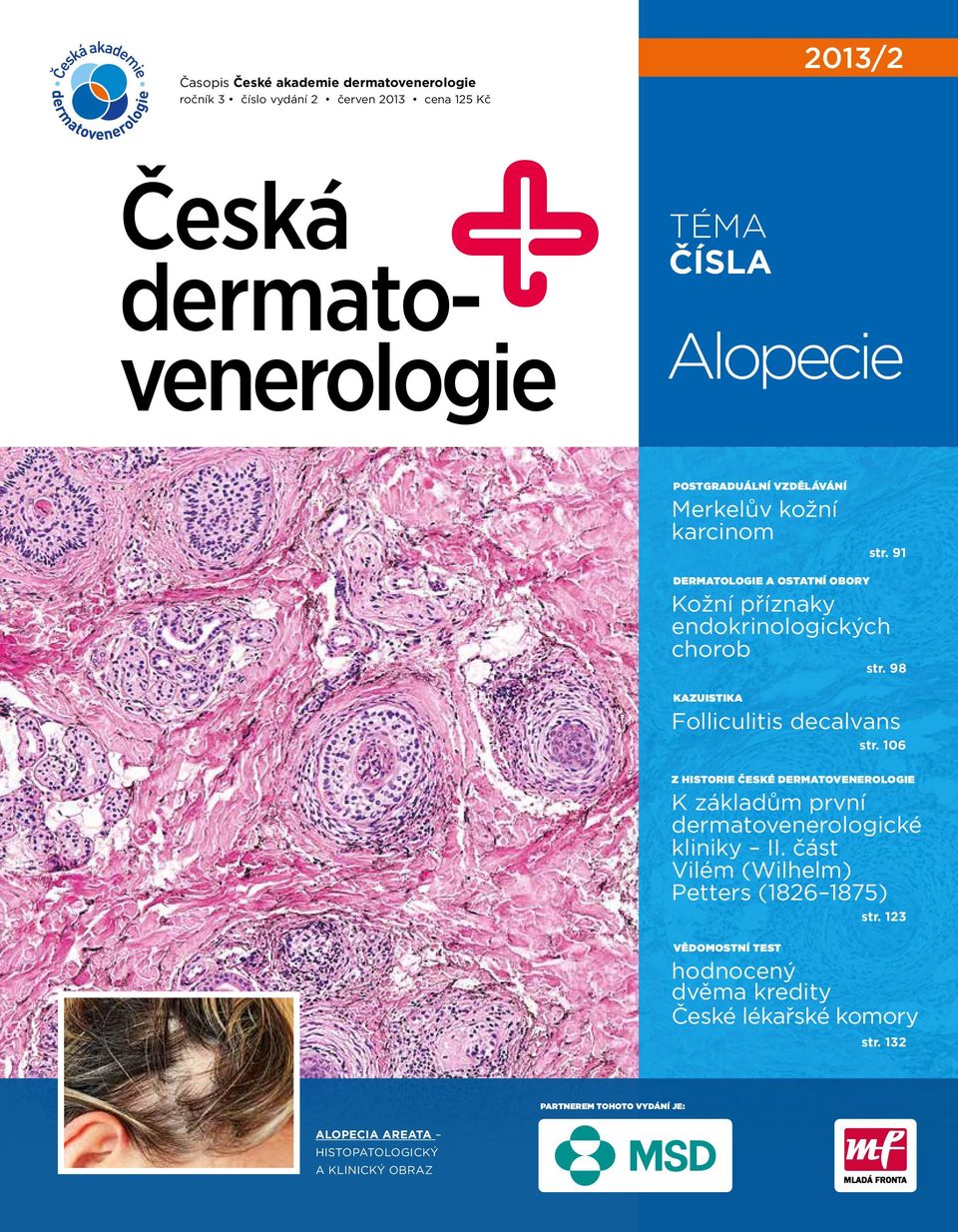 98 KAZUISTIKA Folliculitis decalvans str. 106 Z HISTORIE ČESKÉ DERMATOVENEROLOGIE K základům první dermatovenerologické kliniky II.