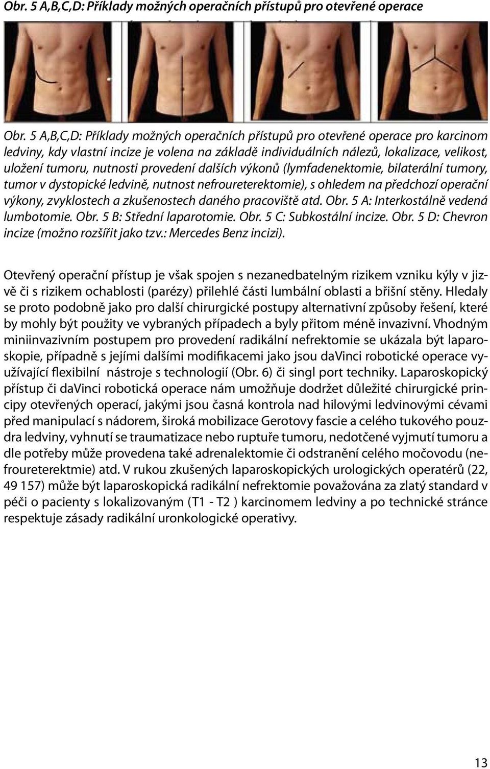 nutnosti provedení dalších výkonů (lymfadenektomie, bilaterální tumory, tumor v dystopické ledvině, nutnost nefroureterektomie), s ohledem na předchozí operační výkony, zvyklostech a zkušenostech