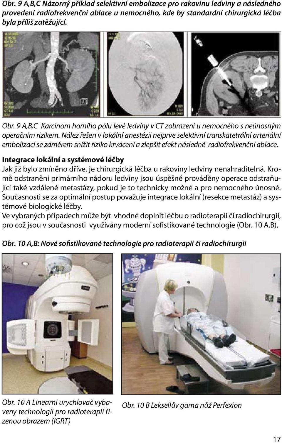 Nález řešen v lokální anestézii nejprve selektivní transkatetrální arteriální embolizací se záměrem snížit riziko krvácení a zlepšit efekt následné radiofrekvenční ablace.