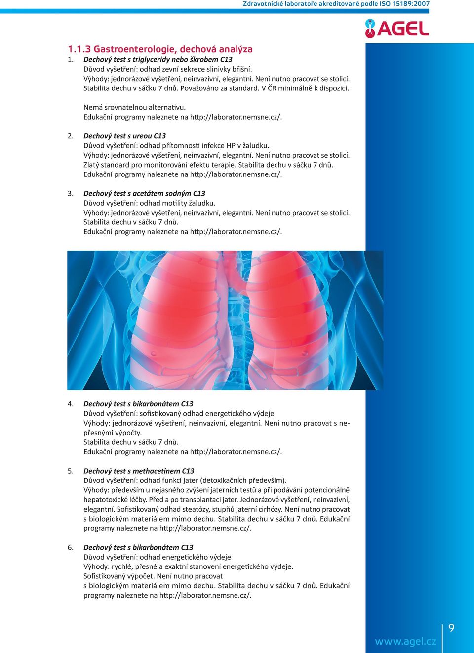 nemsne.cz/. 2. Dechový test s ureou C13 Důvod vyšetření: odhad přítomnosti infekce HP v žaludku. Výhody: jednorázové vyšetření, neinvazivní, elegantní. Není nutno pracovat se stolicí.