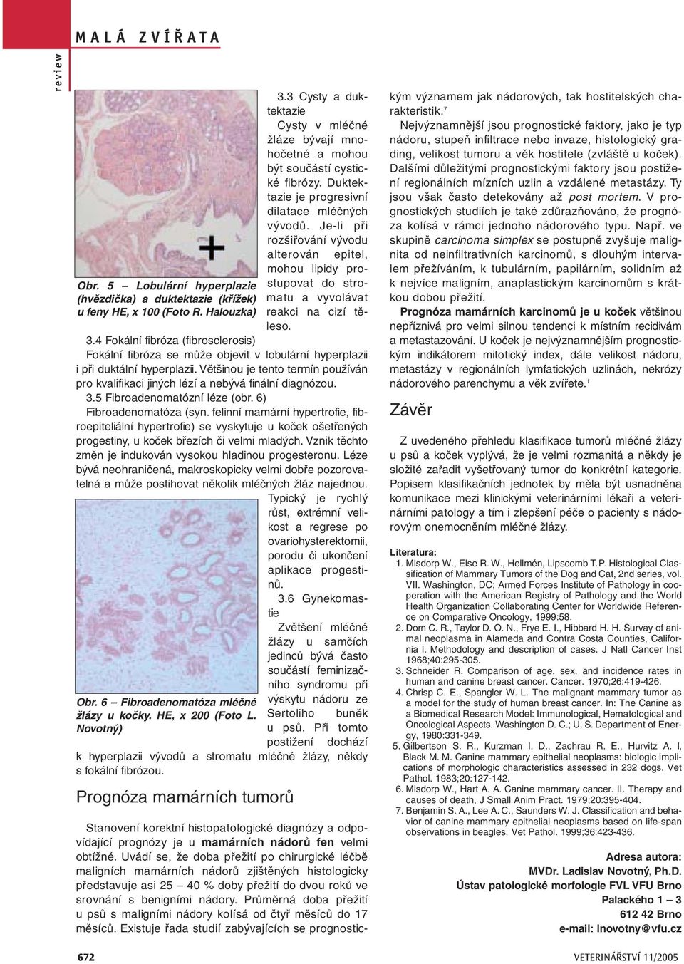 Je-li při rozšiřování vývodu alterován epitel, mohou lipidy prostupovat do stromatu a vyvolávat reakci na cizí těleso. 3.