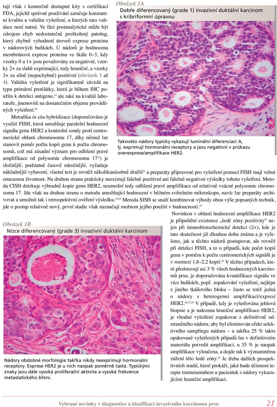 U nádorů je hodnocena membránová exprese proteinu ve škále 0 3, kdy vzorky 0 a 1+ jsou považovány za negativní, vzorky 2+ za slabě exprimující, tedy hraniční, a vzorky 3+ za silně (nepochybně)