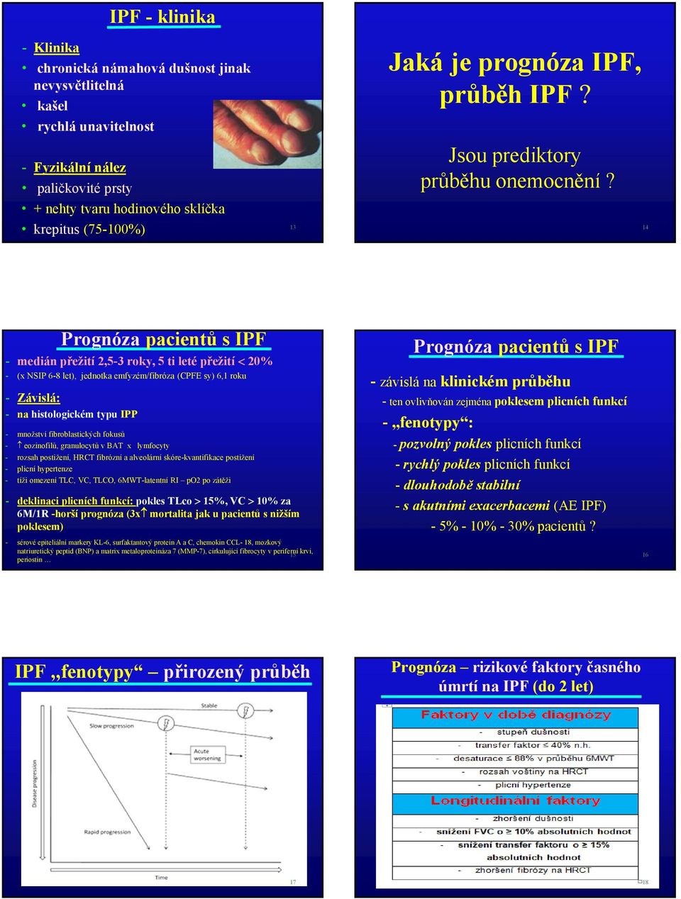 14 Prognóza pacientů s IPF - medián přežití 2,5-3 roky, 5 ti leté přežití < 20% - (x NSIP 6-8 let), jednotka emfyzém/fibróza (CPFE sy) 6,1 roku - Závislá: - na histologickém typu IPP - množství