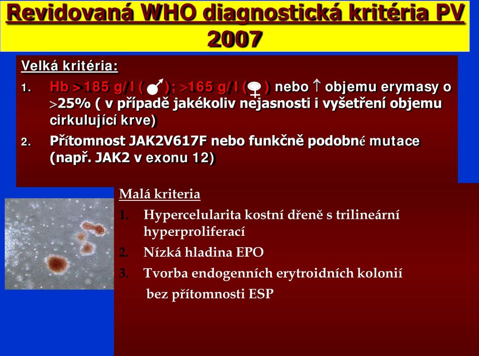 objemu cirkulující krve) 2. Přítomnost JAK2V617F nebo funkčně podobné mutace (např.