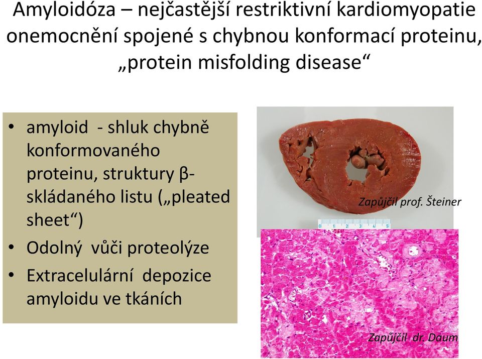 konformovaného proteinu, struktury β skládaného listu ( pleated sheet ) Odolný