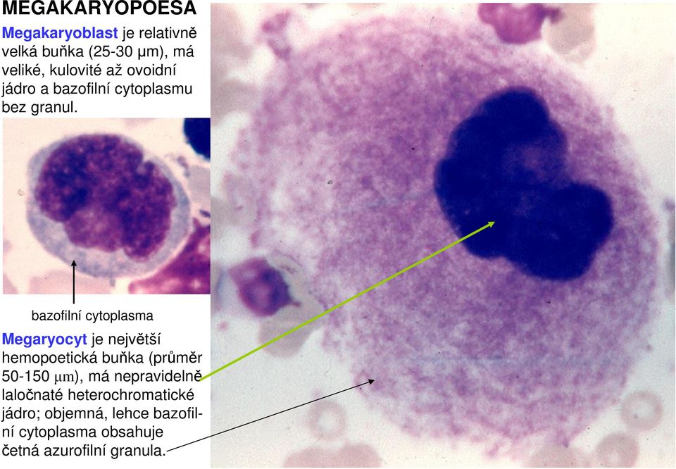 bazofilní cytoplasma Megaryocyt je největší hemopoetická buňka (průměr 50-150 µm), má