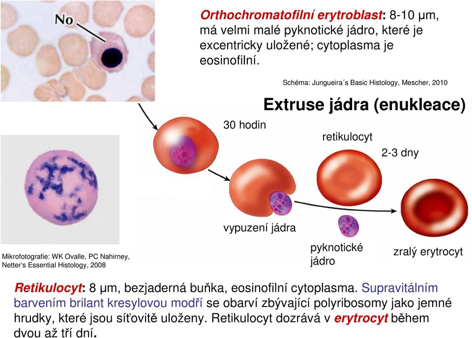 PC Nahirney, Netter s Essential Histology, 2008 pyknotické jádro zralý erytrocyt Retikulocyt: 8 µm, bezjaderná buňka, eosinofilní cytoplasma.