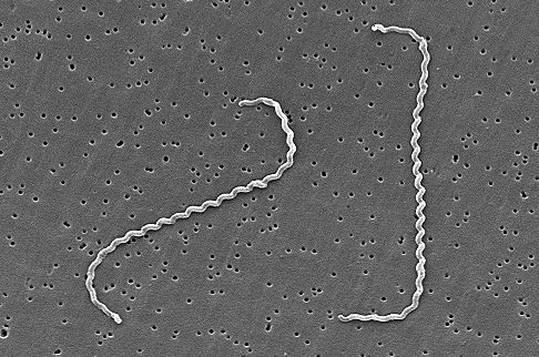 Spirochety Spirální b., dlouhé až 500 µm. Základními bakteriologickými metodami. Významné rody: Treponema T. pallidum syfilis. Leptospira L.