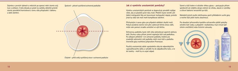 Správně přesně vystřižená ochranná podložka Jak si vyměníte urostomické pomůcky? Výměnu urostomických pomůcek se doporučuje provádět nejlépe vleže, aby se působilo proti toku moči.