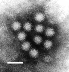 Č: Caliciviridae R: Norovirus R: Sapovirus KALICIVIRY (NOROVIRY) neobalené RNA viry zatím se